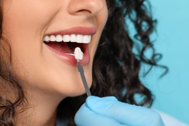 Photo of Doctor checking young woman's teeth color on light blue background, closeup. Dental veneers