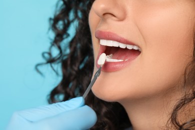 Photo of Doctor checking young woman's teeth color on light blue background, closeup. Dental veneers