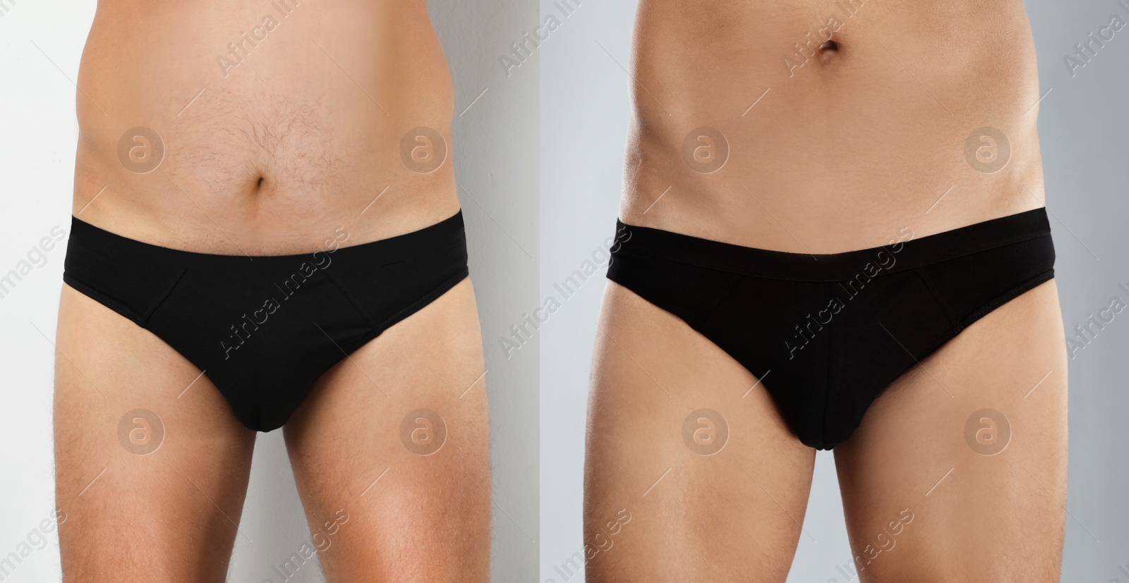 Image of Man before and after weight loss on light grey background, closeup. Collage of photos