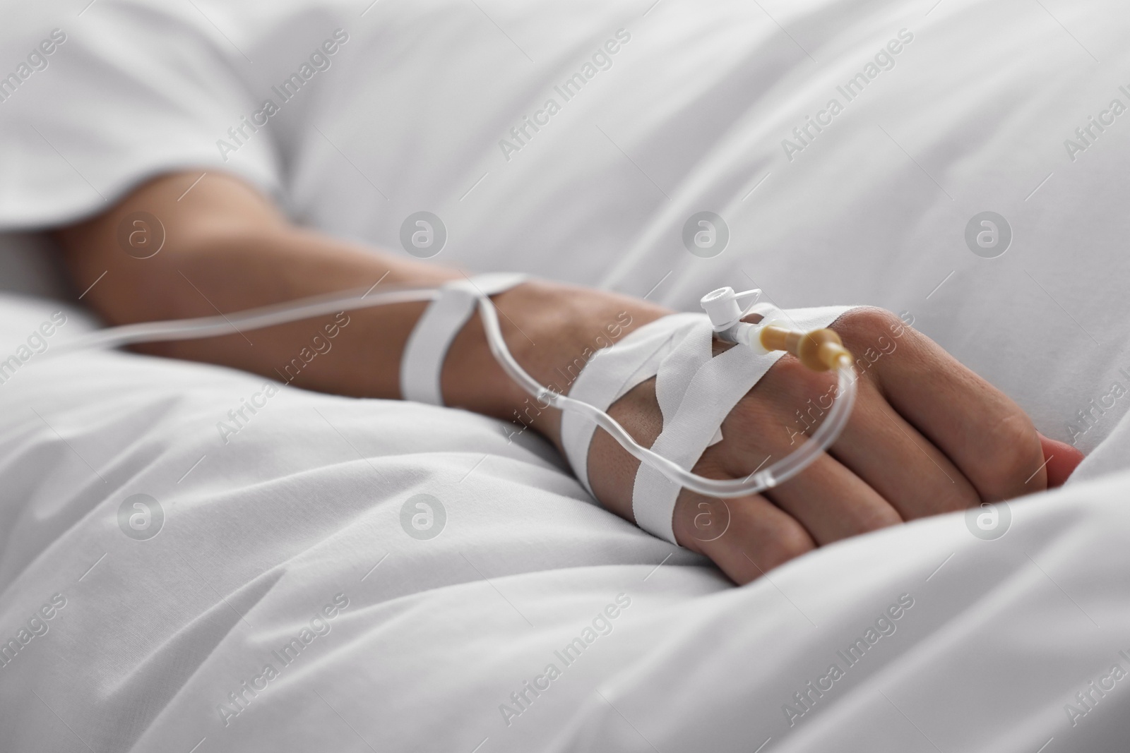 Photo of Coma patient. Man with intravenous drip in hospital bed, closeup