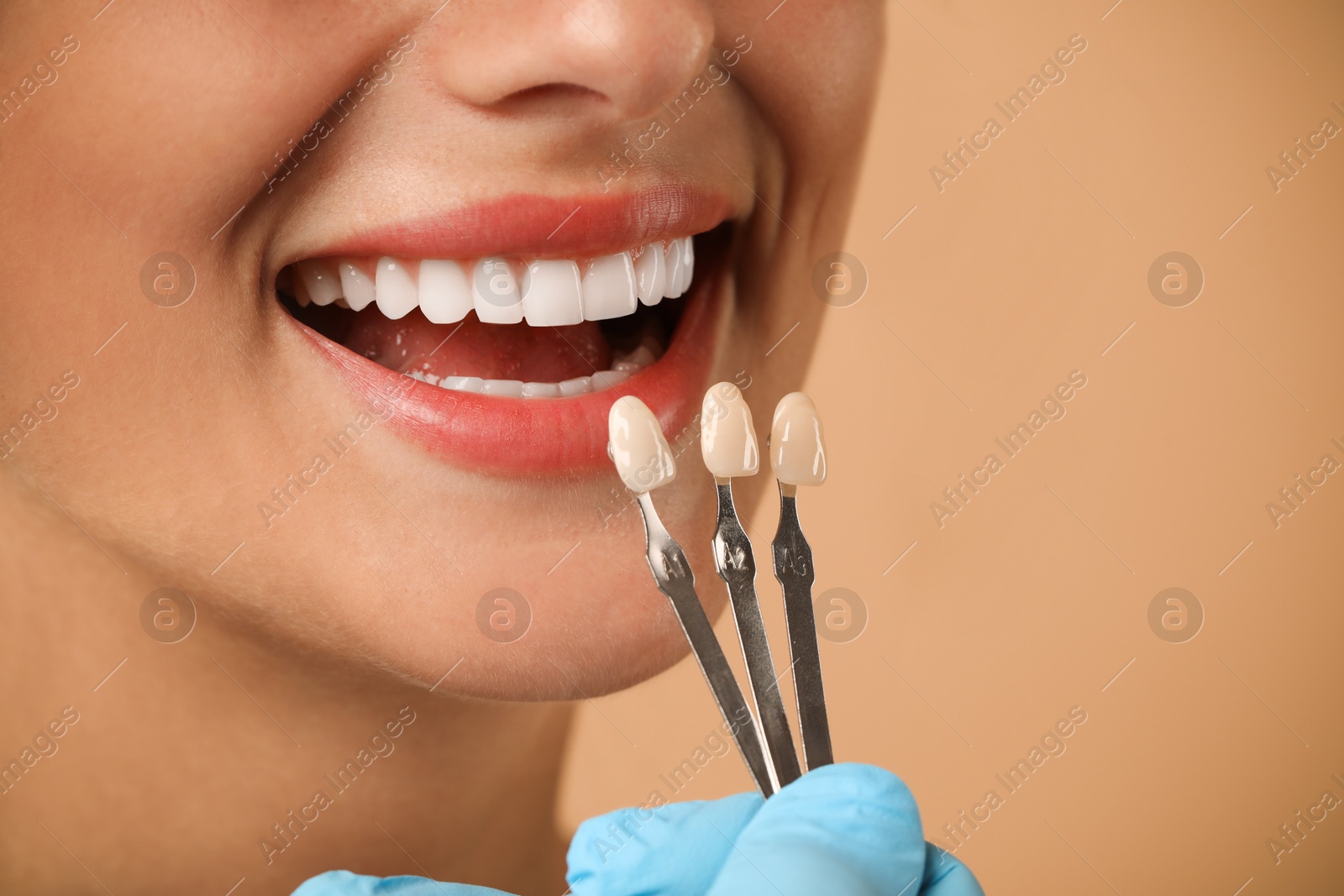 Photo of Doctor checking young woman's teeth color on beige background, closeup. Dental veneers