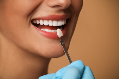 Doctor checking young woman's teeth color on beige background, closeup. Dental veneers