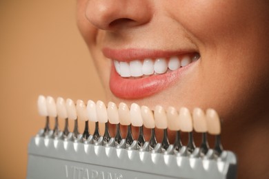 Photo of Smiling woman with teeth color samples on beige background, closeup. Dental veneers