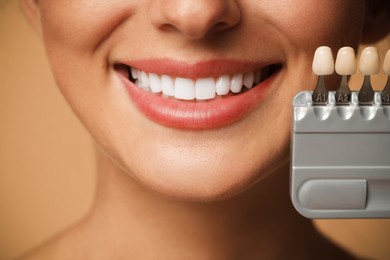 Smiling woman with teeth color samples on beige background, closeup. Dental veneers