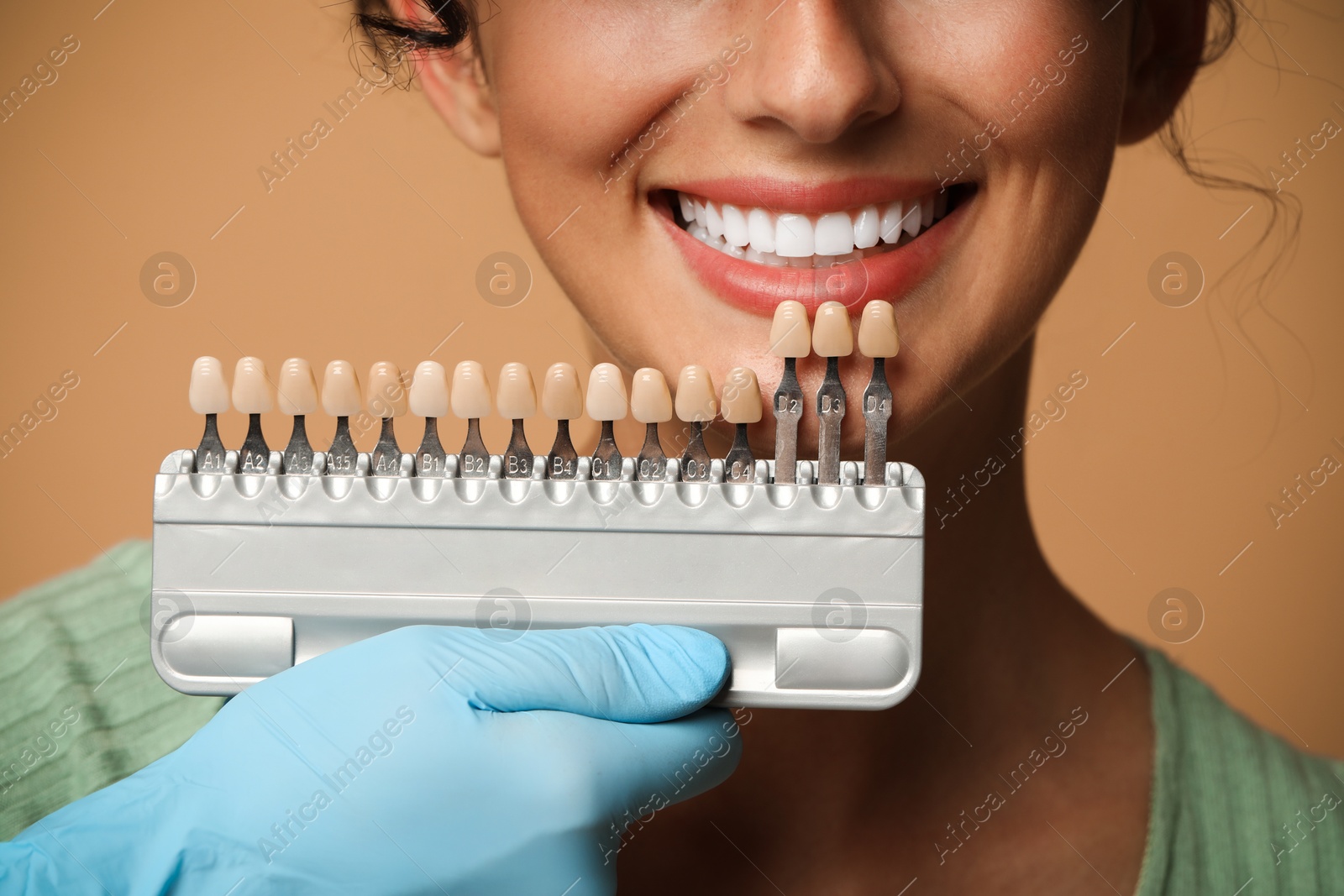 Photo of Doctor checking young woman's teeth color on beige background, closeup. Dental veneers