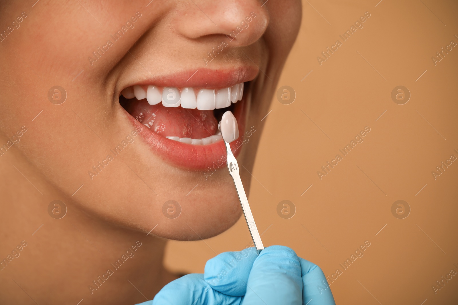 Photo of Doctor checking young woman's teeth color on beige background, closeup. Dental veneers