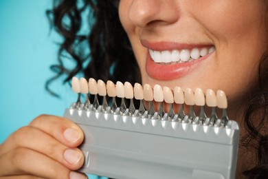 Photo of Smiling woman with teeth color samples on light blue background, closeup. Dental veneers