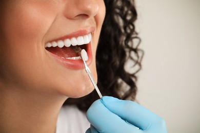 Doctor checking young woman's teeth color on light grey background, closeup. Dental veneers