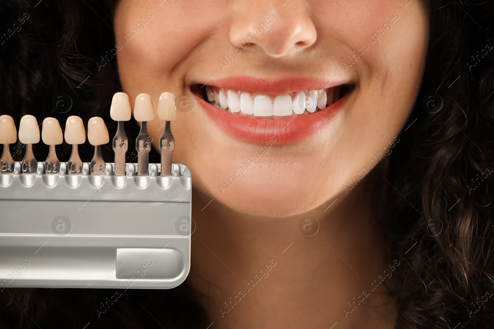 Photo of Smiling woman with teeth color samples, closeup. Dental veneers