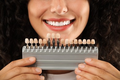 Photo of Smiling woman with teeth color samples, closeup. Dental veneers