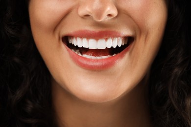 Closeup view of smiling woman. Dental veneers