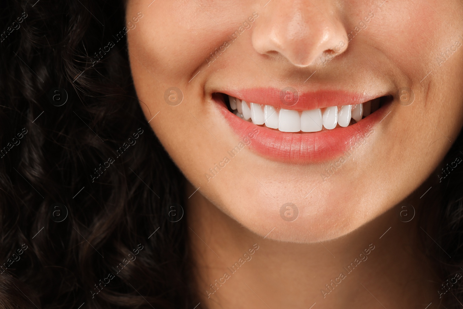 Photo of Closeup view of smiling woman. Dental veneers