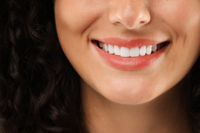 Photo of Closeup view of smiling woman. Dental veneers