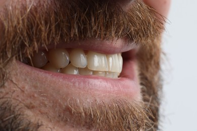 Smiling man with healthy clean teeth on white background, closeup