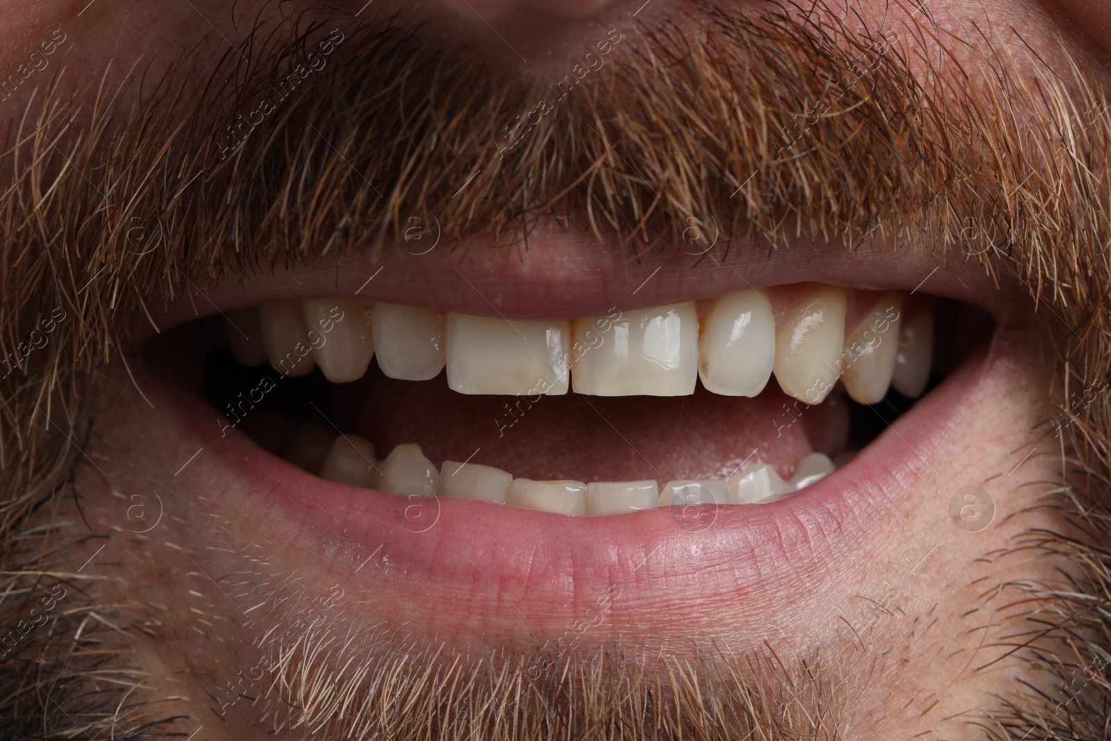 Photo of Smiling man with healthy clean teeth, closeup