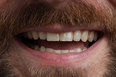 Smiling man with healthy clean teeth, closeup