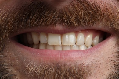 Smiling man with healthy clean teeth, closeup