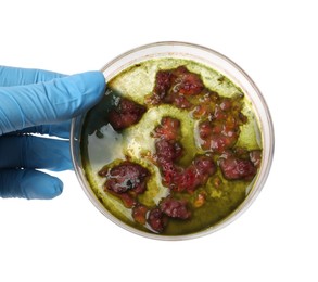 Photo of Laboratory worker holding petri dish with bacteria on white background, closeup