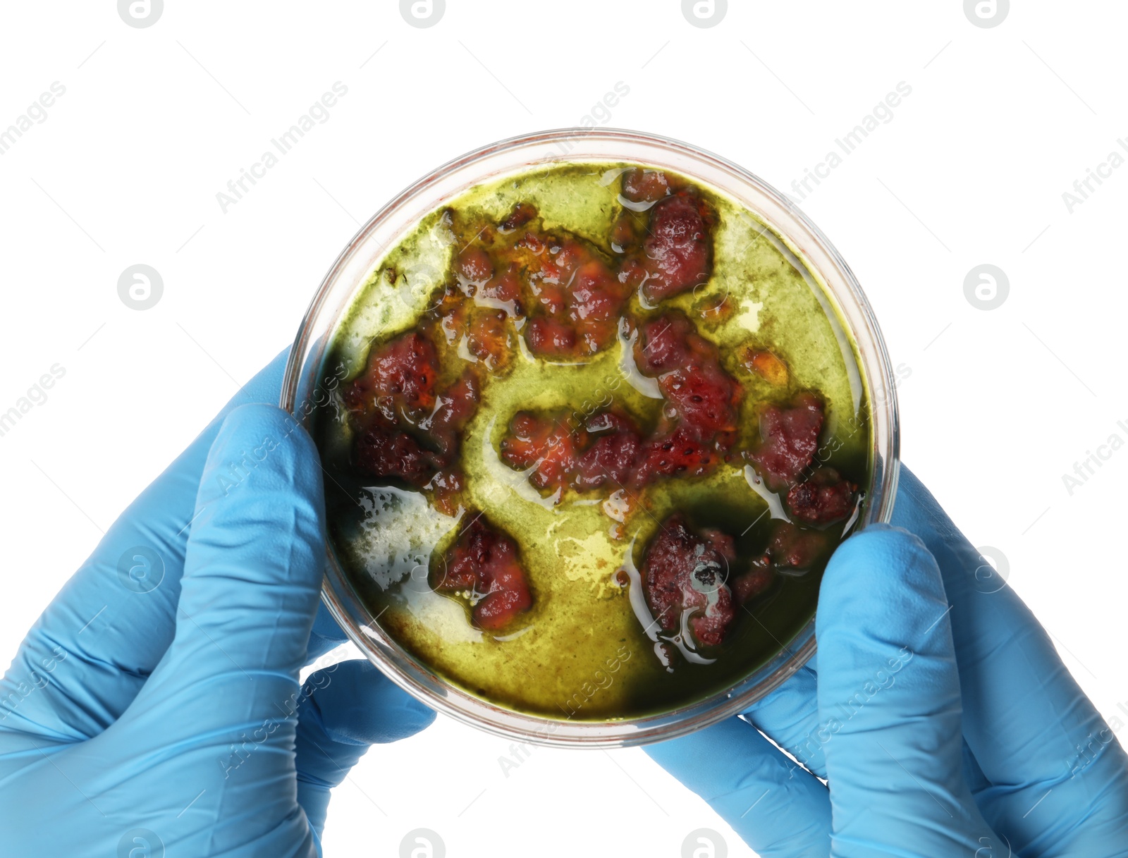 Photo of Laboratory worker holding petri dish with bacteria on white background, closeup