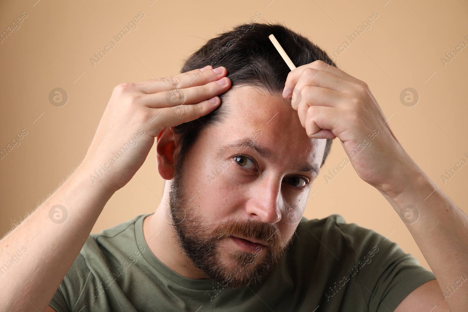 Photo of Man brushing his hair on beige background. Alopecia problem