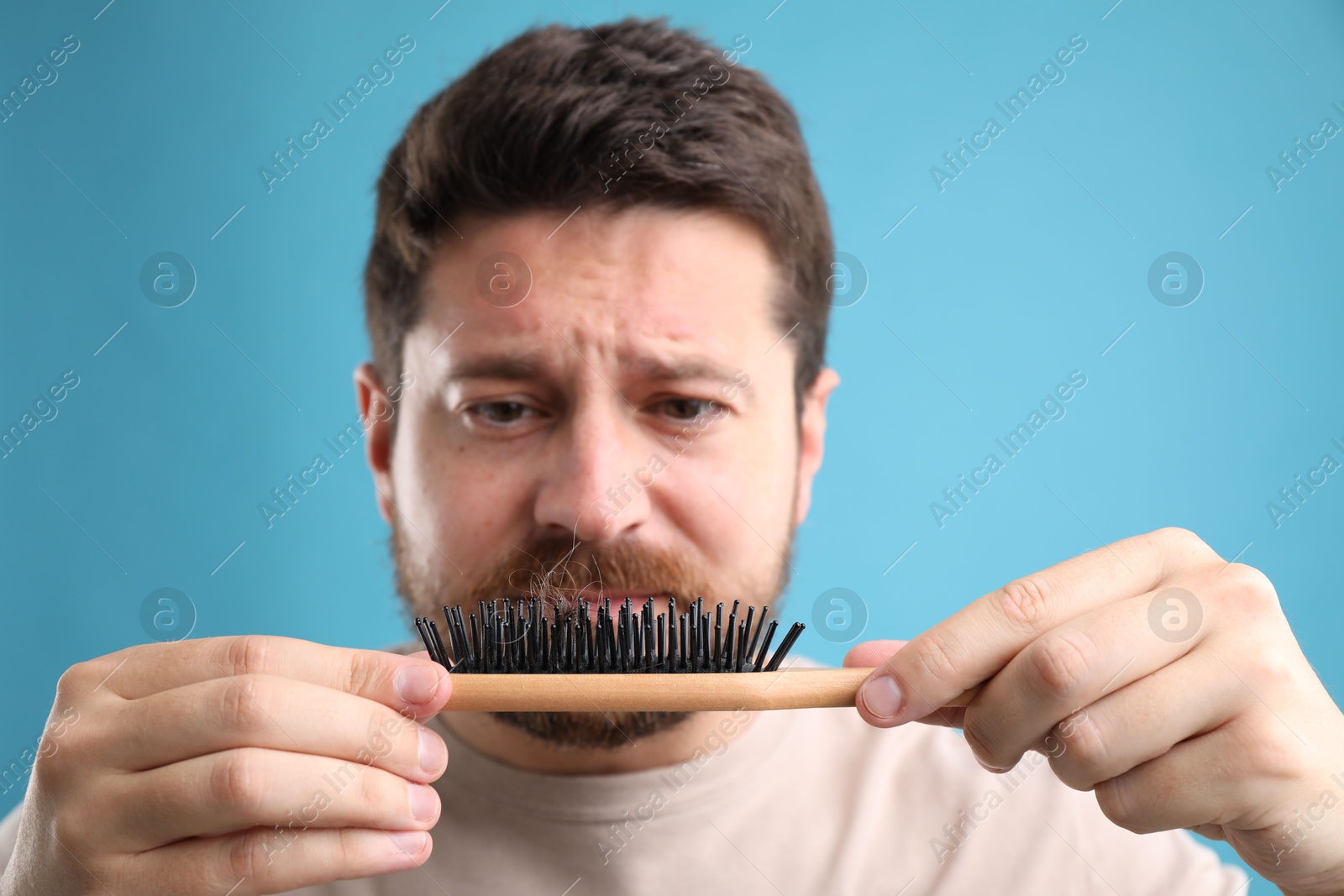 Photo of Sad man holding brush with lost hair on light blue background, selective focus. Alopecia problem