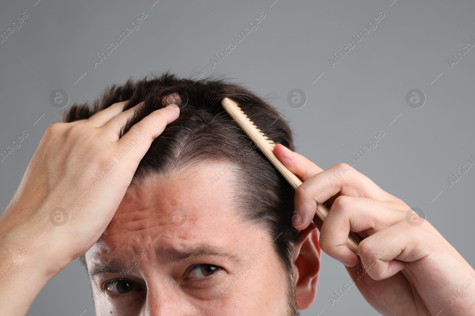 Photo of Man brushing his hair on gray background, closeup. Alopecia problem