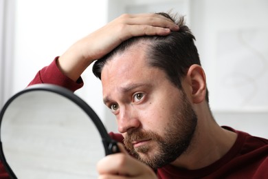 Man with hair loss problem looking at mirror indoors