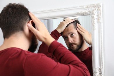 Man with hair loss problem looking at mirror indoors