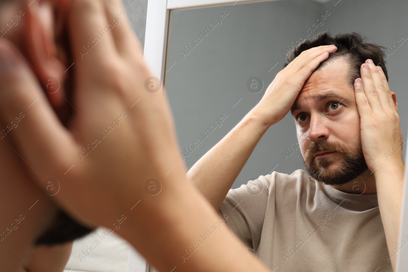 Photo of Man with hair loss problem looking at mirror indoors