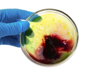 Photo of Laboratory worker holding petri dish with bacteria on white background, closeup