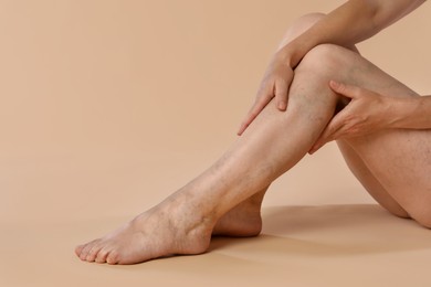 Woman suffering from varicose veins on beige background, closeup. Space for text