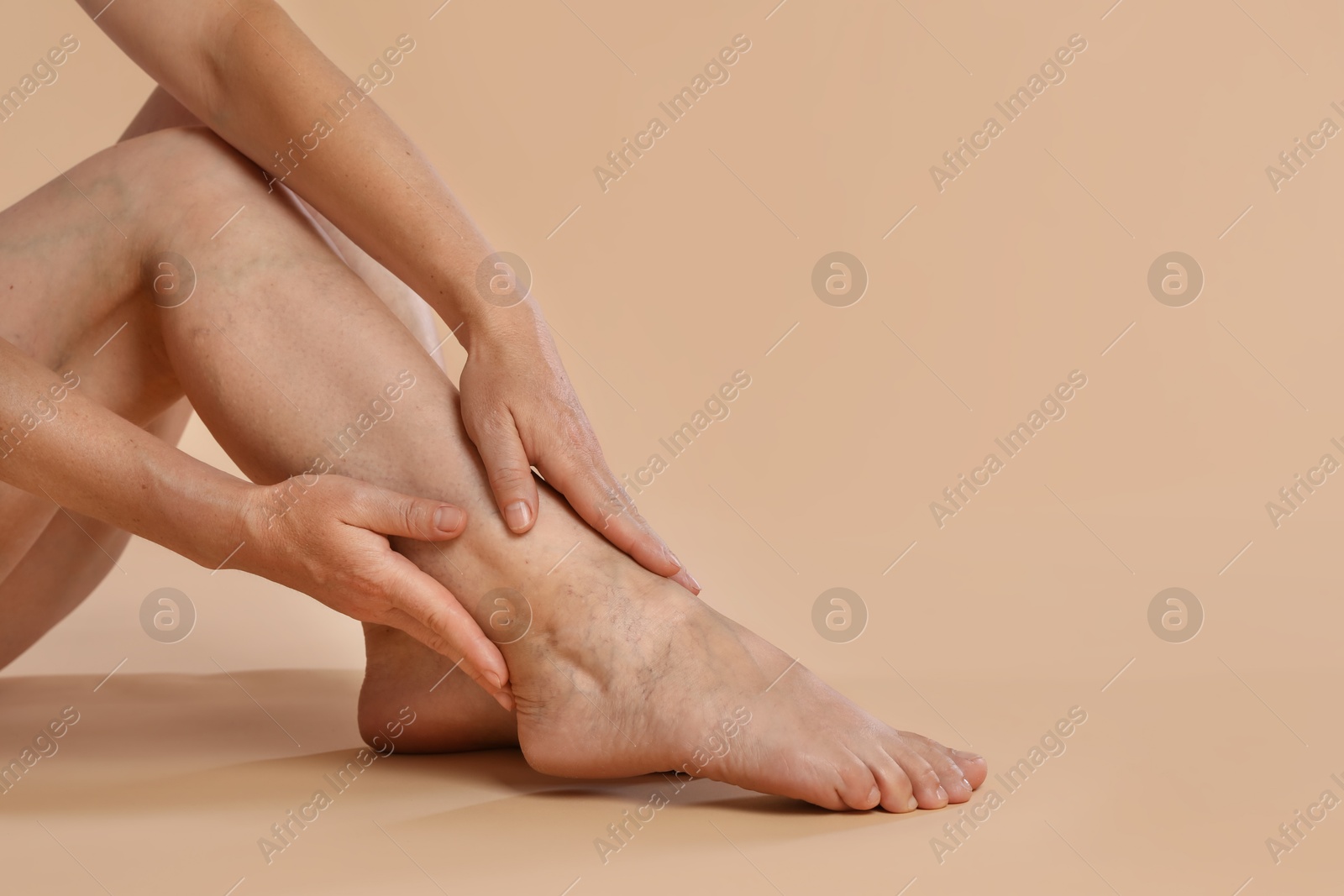 Photo of Woman suffering from varicose veins on beige background, closeup. Space for text