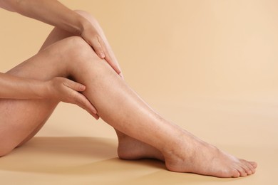 Photo of Woman suffering from varicose veins on beige background, closeup