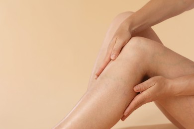 Photo of Woman suffering from varicose veins on beige background, closeup. Space for text