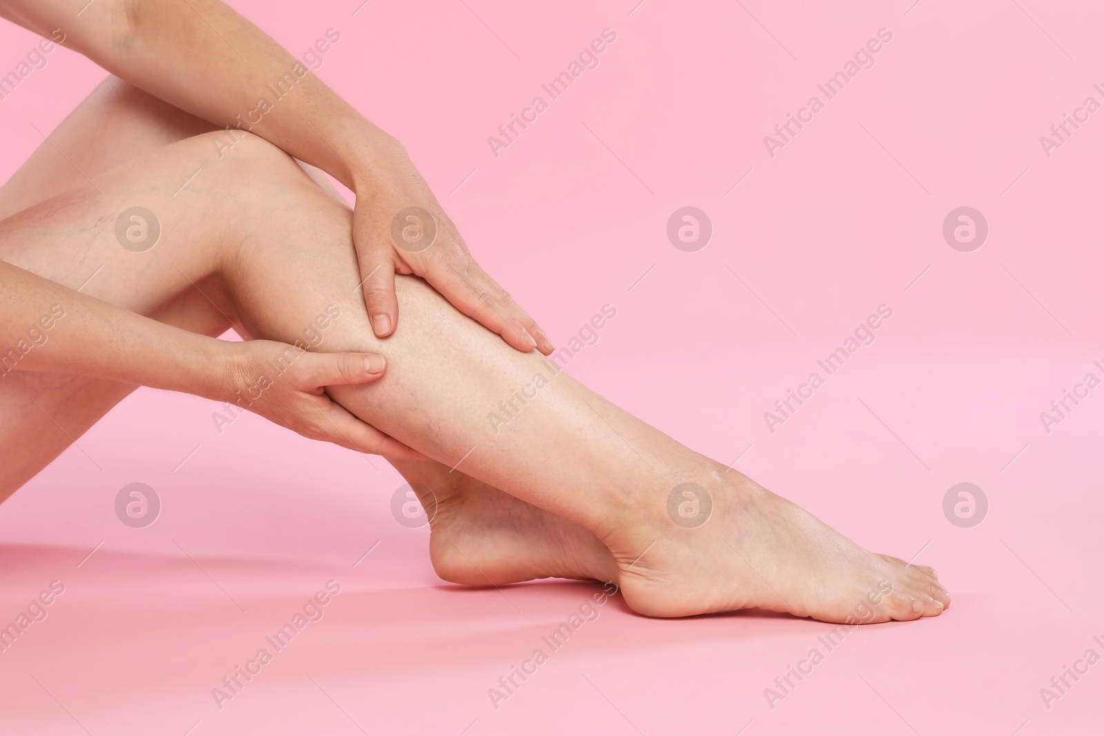 Photo of Woman suffering from varicose veins on pink background, closeup