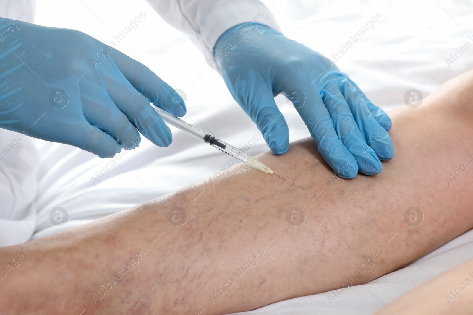 Photo of Varicose veins treatment. Doctor giving injection to patient indoors, closeup