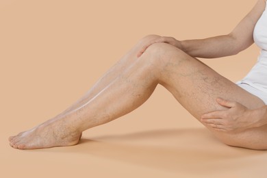 Woman suffering from varicose veins on beige background, closeup