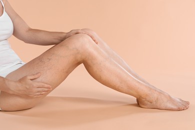 Photo of Woman suffering from varicose veins on beige background, closeup