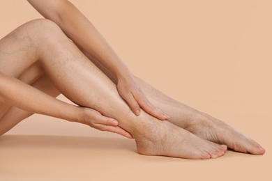 Photo of Woman suffering from varicose veins on beige background, closeup