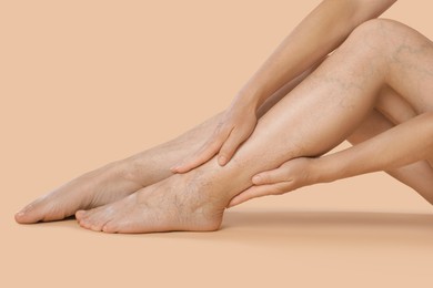 Photo of Woman suffering from varicose veins on beige background, closeup