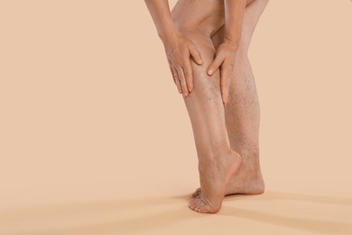 Photo of Woman suffering from varicose veins on beige background, closeup. Space for text