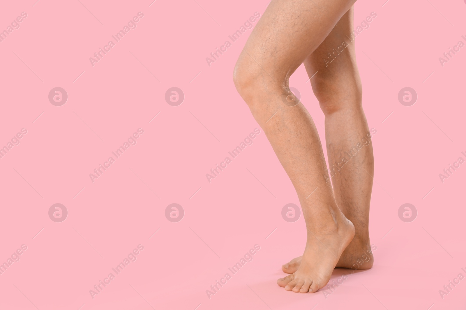 Photo of Woman with varicose veins on pink background, closeup. Space for text