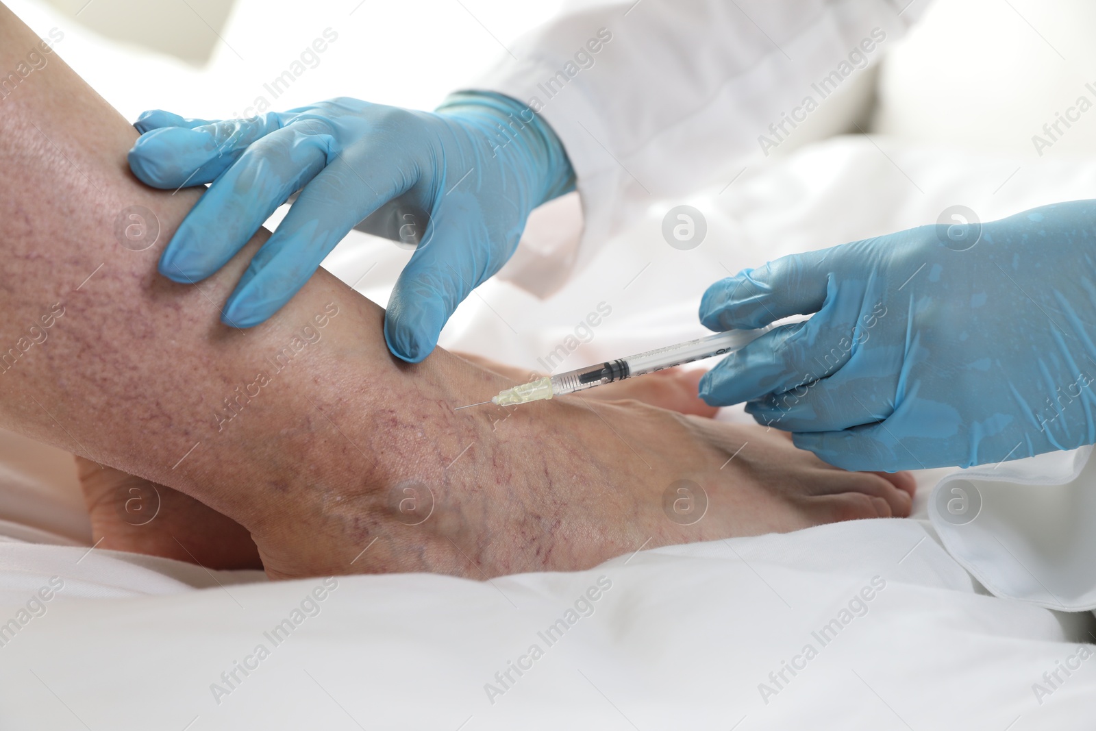 Photo of Varicose veins treatment. Doctor giving injection to patient indoors, closeup