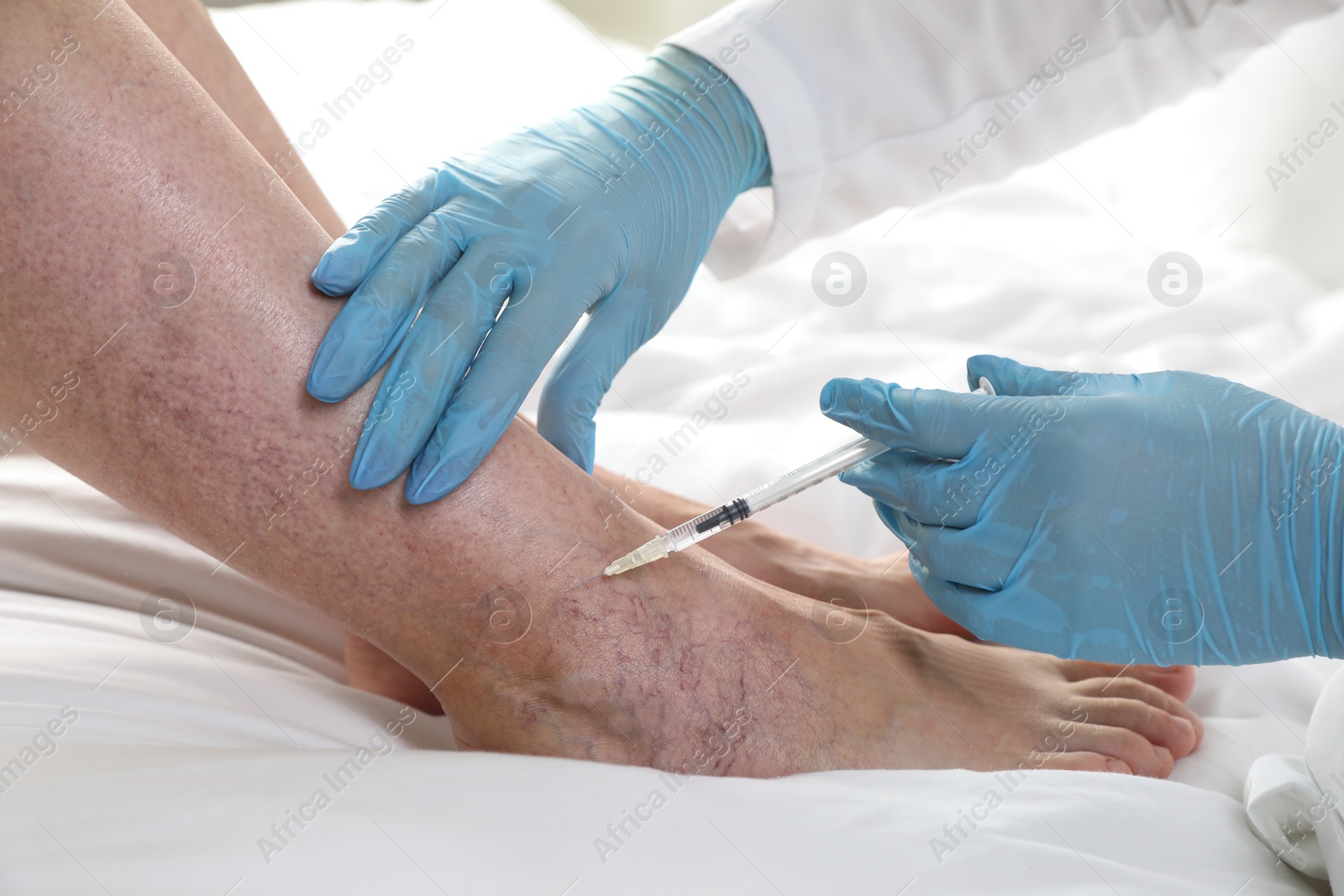 Photo of Varicose veins treatment. Doctor giving injection to patient indoors, closeup