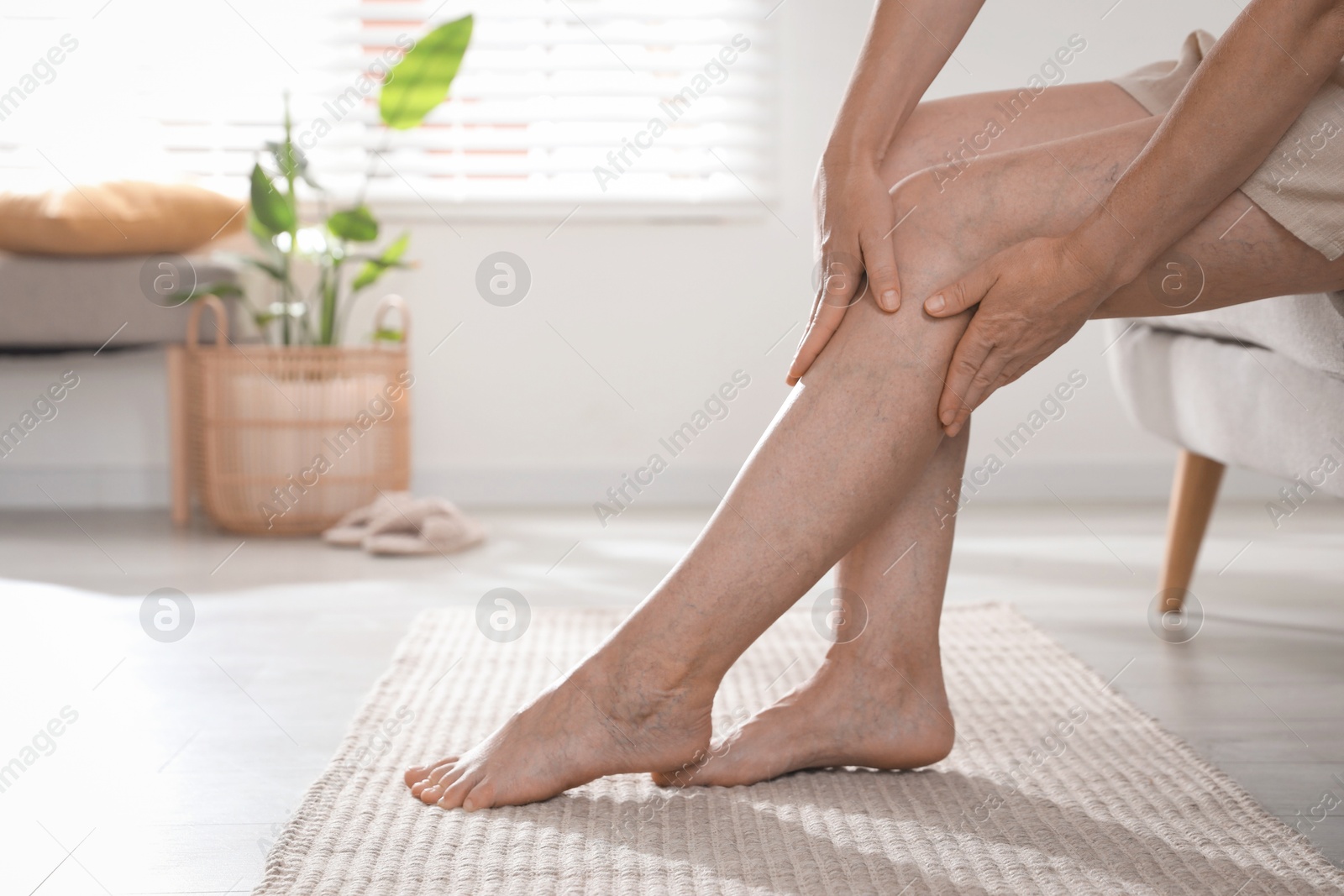 Photo of Woman suffering from varicose veins on sofa indoors, closeup. Space for text