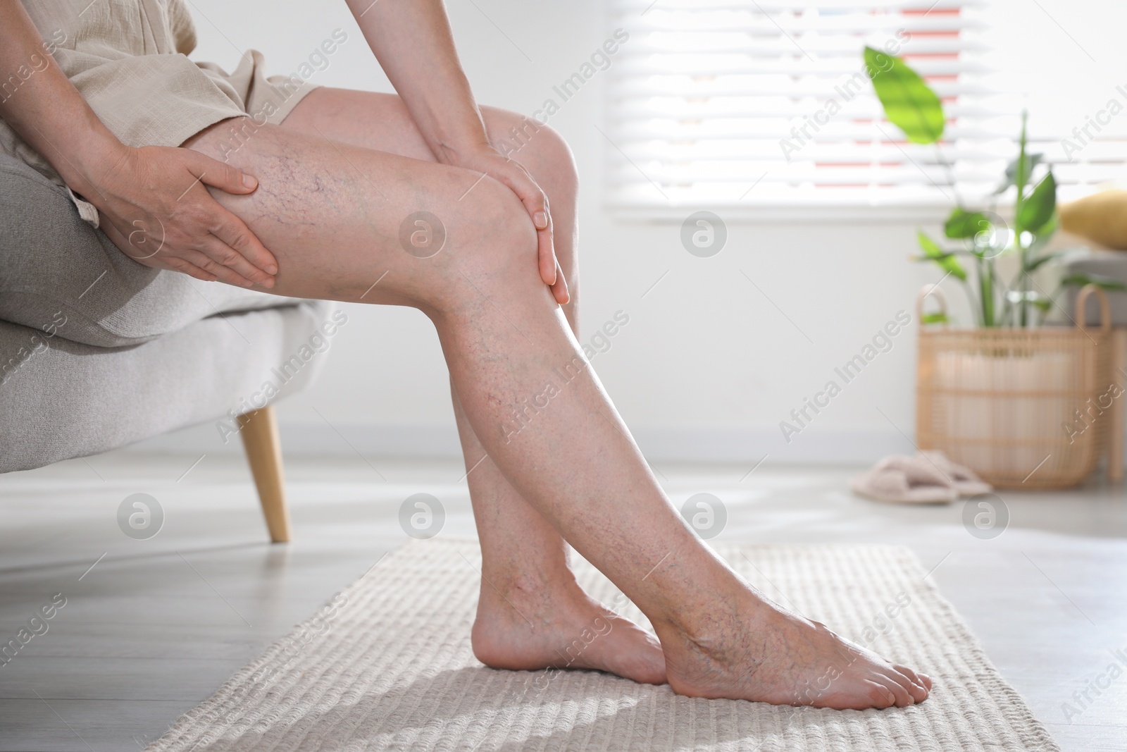 Photo of Woman suffering from varicose veins on sofa indoors, closeup. Space for text