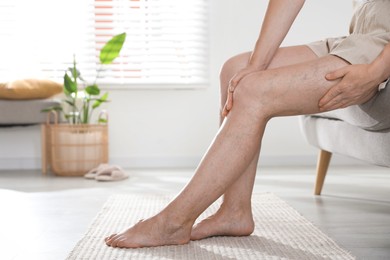 Photo of Woman suffering from varicose veins on sofa indoors, closeup. Space for text