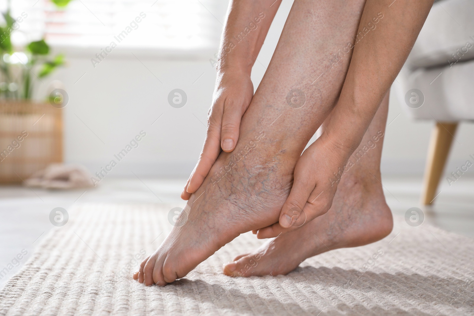 Photo of Woman suffering from varicose veins indoors, closeup. Space for text