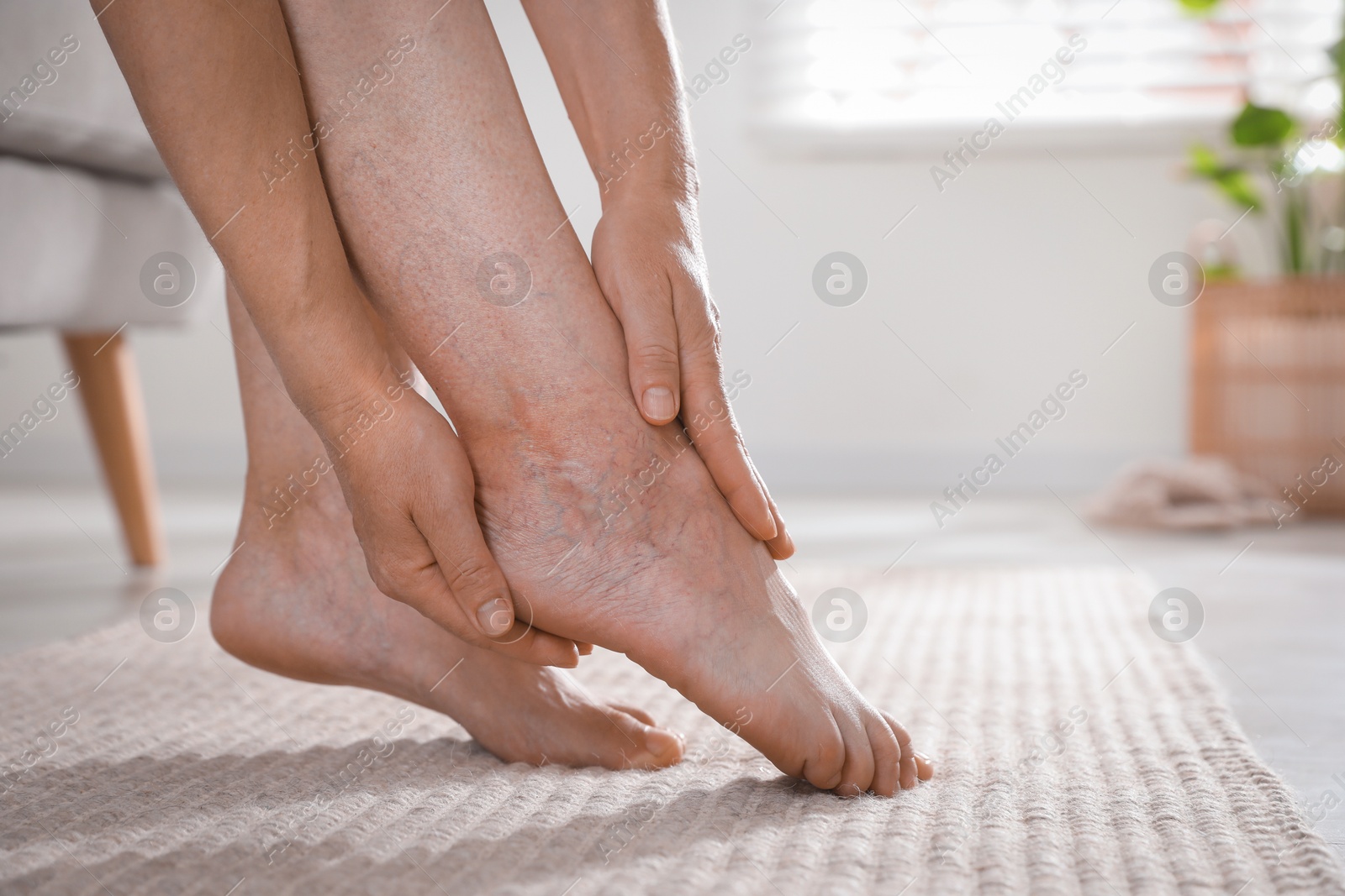 Photo of Woman suffering from varicose veins indoors, closeup. Space for text