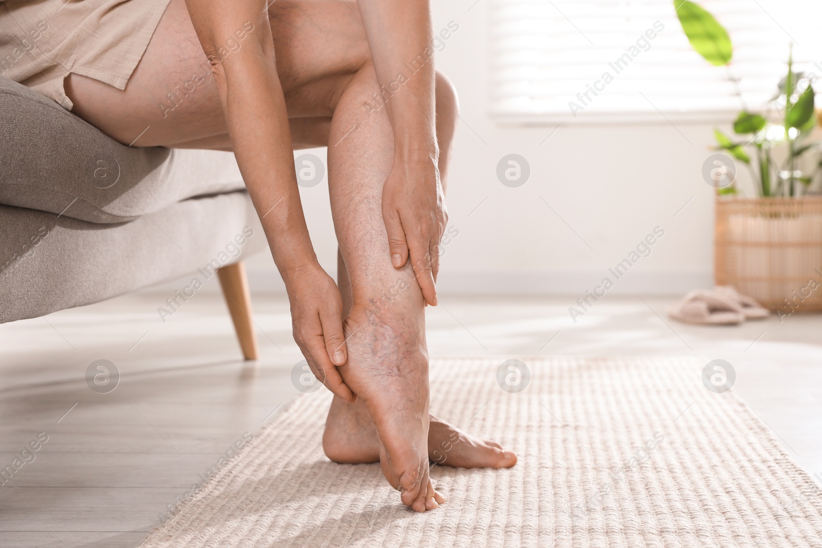 Photo of Woman suffering from varicose veins on sofa indoors, closeup. Space for text